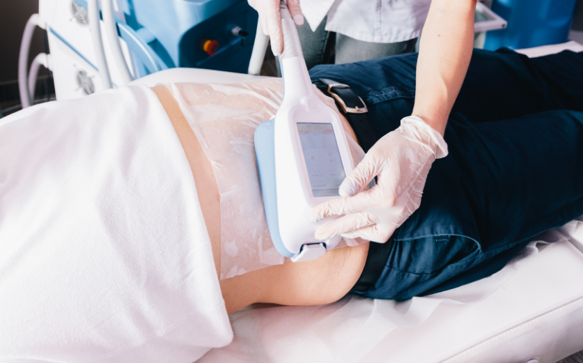 Fat Freezing Treatment
